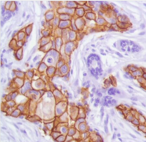 Immunohistochemistry (Formalin/PFA-fixed paraffin-embedded sections) - Anti-ErbB2 / HER2 antibody [SP101] (AB231438)