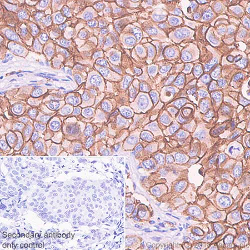 Immunohistochemistry (Formalin/PFA-fixed paraffin-embedded sections) - Anti-ErbB2 / HER2 antibody [SP101] - BSA and Azide free (AB240410)