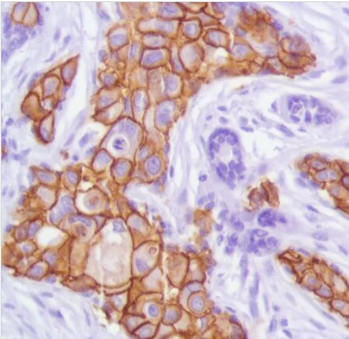 Immunohistochemistry (Formalin/PFA-fixed paraffin-embedded sections) - Anti-ErbB2 / HER2 antibody [SP101] - BSA and Azide free (AB240410)