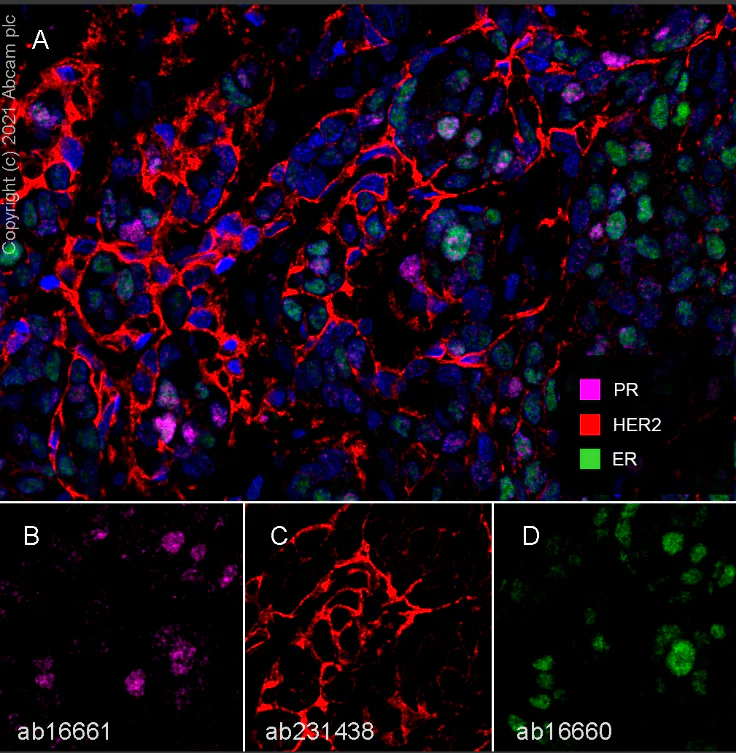 Multiplex immunohistochemistry - Anti-ErbB2 / HER2 antibody [SP101] - BSA and Azide free (AB240410)