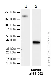 Western blot - Anti-ErbB2 / HER2 antibody [SP101] - BSA and Azide free (AB240410)