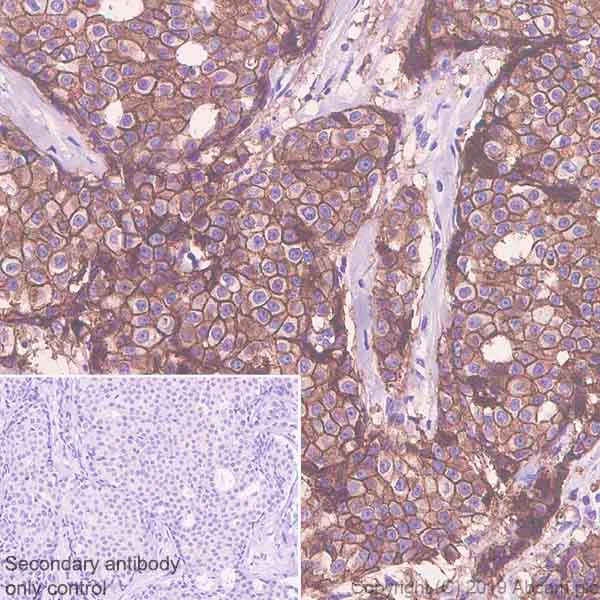 Immunohistochemistry (Formalin/PFA-fixed paraffin-embedded sections) - Anti-ErbB2 / HER2 antibody [SP3] (AB16662)
