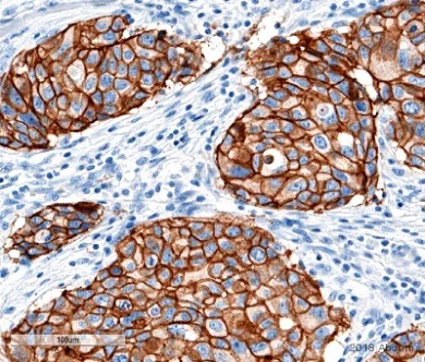 Immunohistochemistry (Formalin/PFA-fixed paraffin-embedded sections) - Anti-ErbB2 / HER2 antibody [SP3] (AB16662)