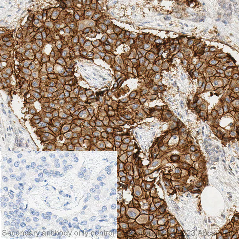 Immunohistochemistry (Formalin/PFA-fixed paraffin-embedded sections) - Anti-ErbB2 / HER2 antibody [SP3] (AB16662)