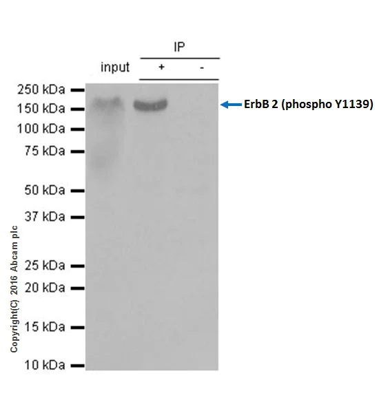 Immunoprecipitation - Anti-ErbB2 / HER2 (phospho Y1139) antibody [EP1046Y] (AB53290)