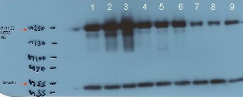 Western blot - Anti-ErbB2 / HER2 (phospho Y1139) antibody [EP1046Y] (AB53290), expandable thumbnail