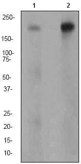 Western blot - Anti-ErbB2 / HER2 (phospho Y1139) antibody [EP1046Y] - BSA and Azide free (AB182447)
