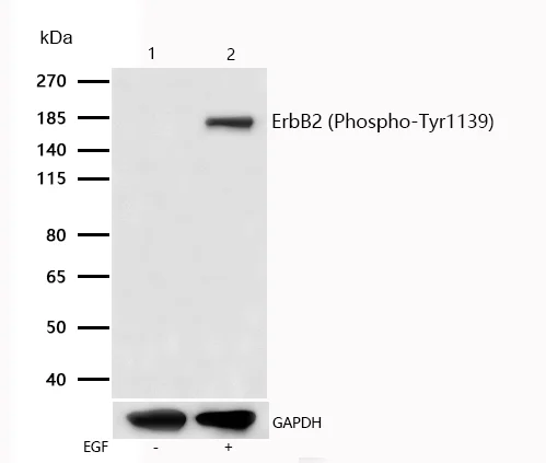 Western blot - Anti-ErbB2 / HER2 (phospho Y1139) antibody [SR1274] (AB326662)