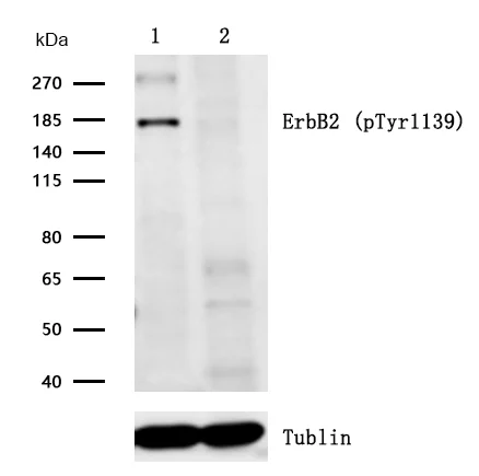 Western blot - Anti-ErbB2 / HER2 (phospho Y1139) antibody [SR1274] (AB326662)