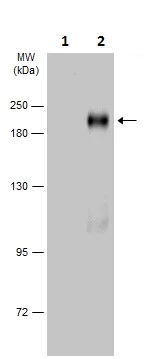 Western blot - Anti-ErbB2 / HER2 (phospho Y1196) antibody (AB227088)