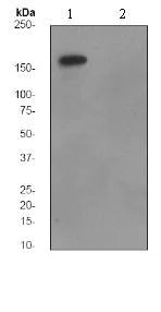 Western blot - Anti-ErbB2 / HER2 (phospho Y1221 + Y1222) antibody [EPR1047] (AB91633)