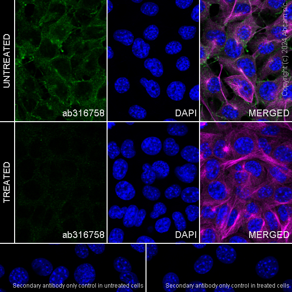 Anti-ErbB2 / HER2 (phospho Y1221 + Y1222) antibody [EPR28391