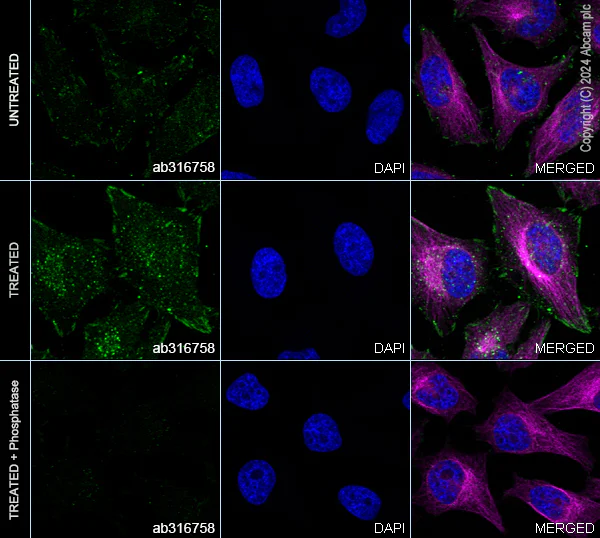 Immunocytochemistry/ Immunofluorescence - Anti-ErbB2 / HER2 (phospho Y1221 + Y1222) antibody [EPR28391-67] - BSA and Azide free (AB316759)