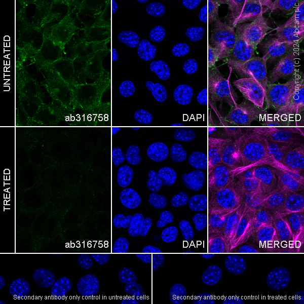 Immunocytochemistry/ Immunofluorescence - Anti-ErbB2 / HER2 (phospho Y1221 + Y1222) antibody [EPR28391-67] - BSA and Azide free (AB316759)