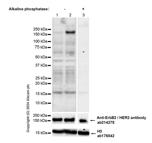 Western blot - Anti-ErbB2 / HER2 (phospho Y1221 + Y1222) antibody [EPR28391-67] - BSA and Azide free (AB316759)