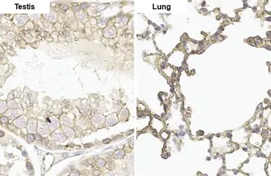 Immunohistochemistry (Formalin/PFA-fixed paraffin-embedded sections) - Anti-ErbB2 / HER2 (phospho Y1248) antibody [HL1466] - BSA and Azide free (AB313853), expandable thumbnail