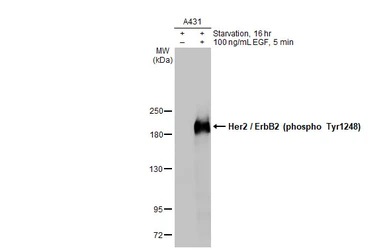 Western blot - Anti-ErbB2 / HER2 (phospho Y1248) antibody [HL1466] - BSA and Azide free (AB313853), expandable thumbnail