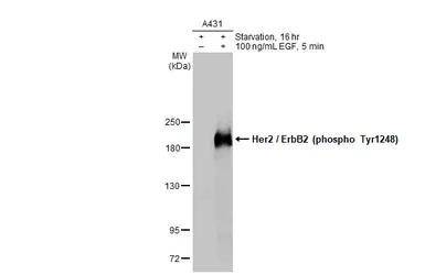 Western blot - Anti-ErbB2 / HER2 (phospho Y1248) antibody [HL1466] - BSA and Azide free (AB313853)