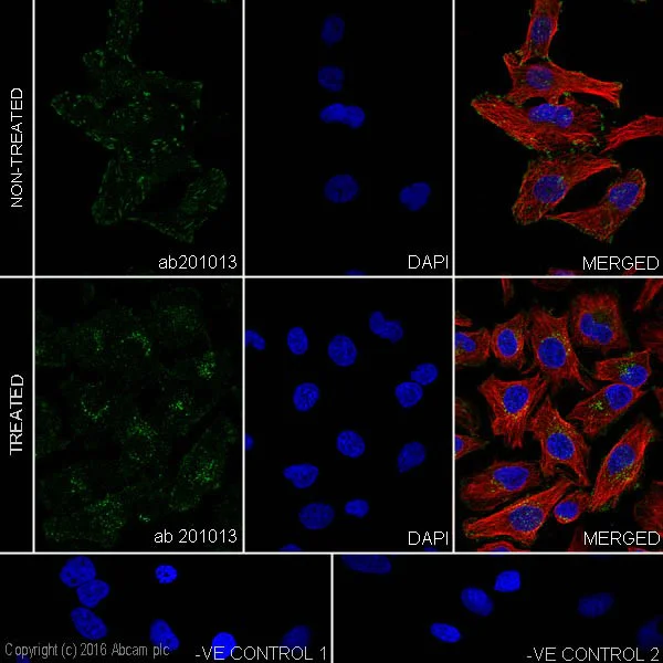 Immunocytochemistry/ Immunofluorescence - Anti-ErbB2 / HER2 (phospho Y1248) + ErbB4 / HER4 (phospho Y1284) antibody [EPR19547] (AB201013)