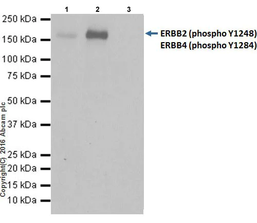 Immunoprecipitation - Anti-ErbB2 / HER2 (phospho Y1248) + ErbB4 / HER4 (phospho Y1284) antibody [EPR19547] (AB201013)