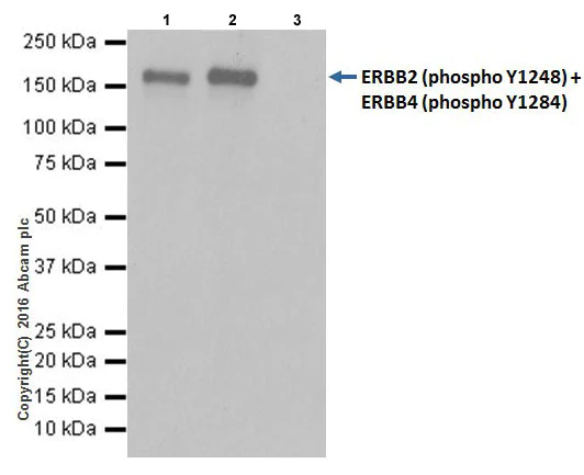 Immunoprecipitation - Anti-ErbB2 / HER2 (phospho Y1248) + ErbB4 / HER4 (phospho Y1284) antibody [EPR19547] (AB201013)