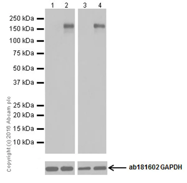 Western blot - Anti-ErbB2 / HER2 (phospho Y1248) + ErbB4 / HER4 (phospho Y1284) antibody [EPR19547] (AB201013)