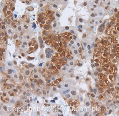 Immunohistochemistry (Formalin/PFA-fixed paraffin-embedded sections) - Anti-ErbB2 / HER2 (phospho Y877) antibody (AB47262)