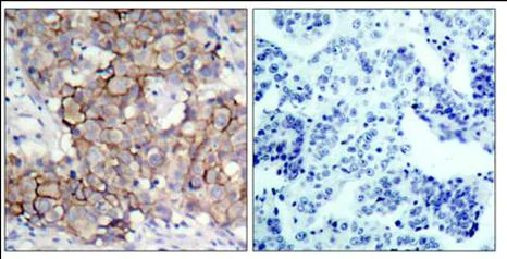 Immunohistochemistry (Formalin/PFA-fixed paraffin-embedded sections) - Anti-ErbB2 / HER2 (phospho Y877) antibody (AB47262)