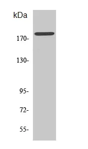 Western blot - Anti-ErbB2 / HER2 (phospho Y877) antibody (AB47262)