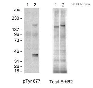 Western blot - Anti-ErbB2 / HER2 (phospho Y877) antibody (AB47262)