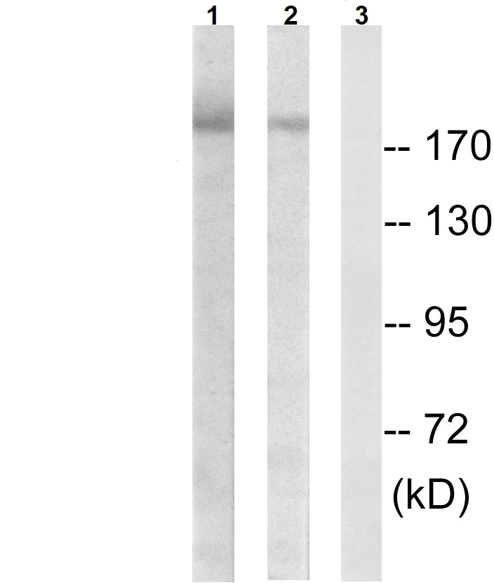 Western blot - Anti-ErbB2 / HER2 (phospho Y877) antibody (AB47262)