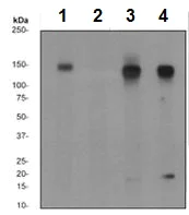 Western blot - Anti-ErbB2 / HER2 (phospho Y877) antibody [EP2324Y] (AB108371)