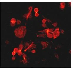 Immunocytochemistry/ Immunofluorescence - Anti-ErbB2 / HER2 (phospho Y877) antibody [EP2324Y] - BSA and Azide free (AB238437)