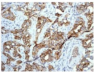 Immunohistochemistry (Formalin/PFA-fixed paraffin-embedded sections) - Anti-ErbB2 / HER2 (phospho Y877) antibody [EP2324Y] - BSA and Azide free (AB238437)