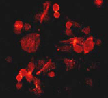 Immunocytochemistry/ Immunofluorescence - Anti-ErbB2 / HER2 (phospho Y877) antibody [EPR2324Y] - BSA and Azide free (AB247413), expandable thumbnail