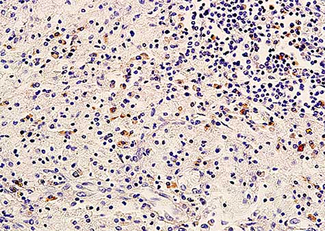 Immunohistochemistry (Formalin/PFA-fixed paraffin-embedded sections) - Anti-ErbB3 / HER3 antibody (AB217206), expandable thumbnail