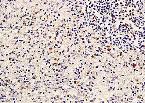 Immunohistochemistry (Formalin/PFA-fixed paraffin-embedded sections) - Anti-ErbB3 / HER3 antibody (AB217206)