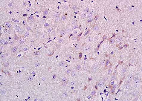 Immunohistochemistry (Formalin/PFA-fixed paraffin-embedded sections) - Anti-ErbB3 / HER3 antibody (AB217206), expandable thumbnail