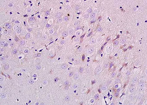 Immunohistochemistry (Formalin/PFA-fixed paraffin-embedded sections) - Anti-ErbB3 / HER3 antibody (AB217206)