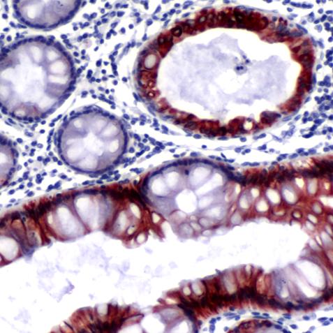 Immunohistochemistry (Formalin/PFA-fixed paraffin-embedded sections) - Anti-ErbB3 / HER3 antibody (AB227775)