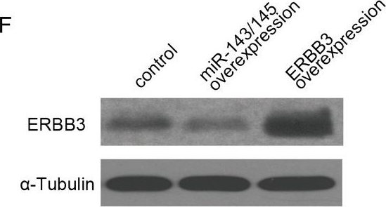 Western blot - Anti-ErbB3 / HER3 antibody (AB34641)