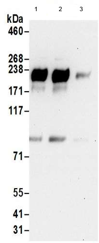 Immunoprecipitation - Anti-ErbB3 / HER3 antibody - C-terminal (AB190269)