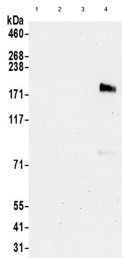 Western blot - Anti-ErbB3 / HER3 antibody - C-terminal (AB190269)
