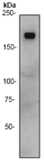 Western blot - Anti-ErbB3 / HER3 antibody [E186] (AB32121), expandable thumbnail