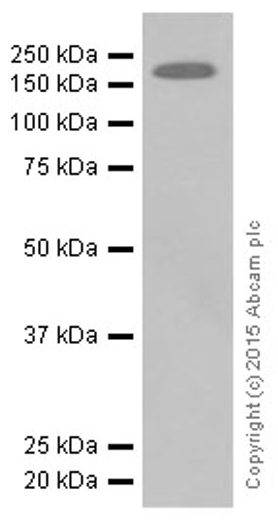 Western blot - Anti-ErbB3 / HER3 antibody [E186] (AB32121), expandable thumbnail
