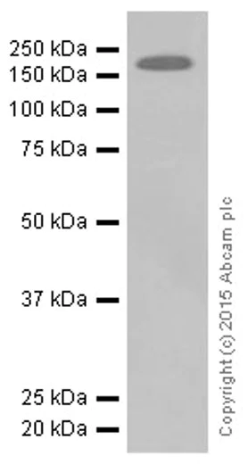 Western blot - Anti-ErbB3 / HER3 antibody [E186] (AB32121)