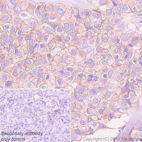 Immunohistochemistry (Formalin/PFA-fixed paraffin-embedded sections) - Anti-ErbB3 / HER3 antibody [EPR22669-25] (AB255607)