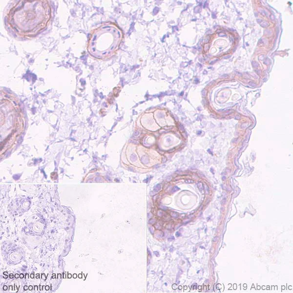 Immunohistochemistry (Formalin/PFA-fixed paraffin-embedded sections) - Anti-ErbB3 / HER3 antibody [EPR22669-25] (AB255607)