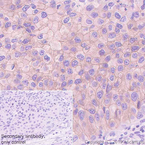 Immunohistochemistry (Formalin/PFA-fixed paraffin-embedded sections) - Anti-ErbB3 / HER3 antibody [EPR22669-25] (AB255607)
