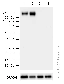 Western blot - Anti-ErbB3 / HER3 antibody [EPR22669-25] (AB255607)